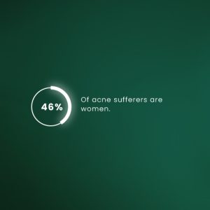 ACNE X6 - Image 3